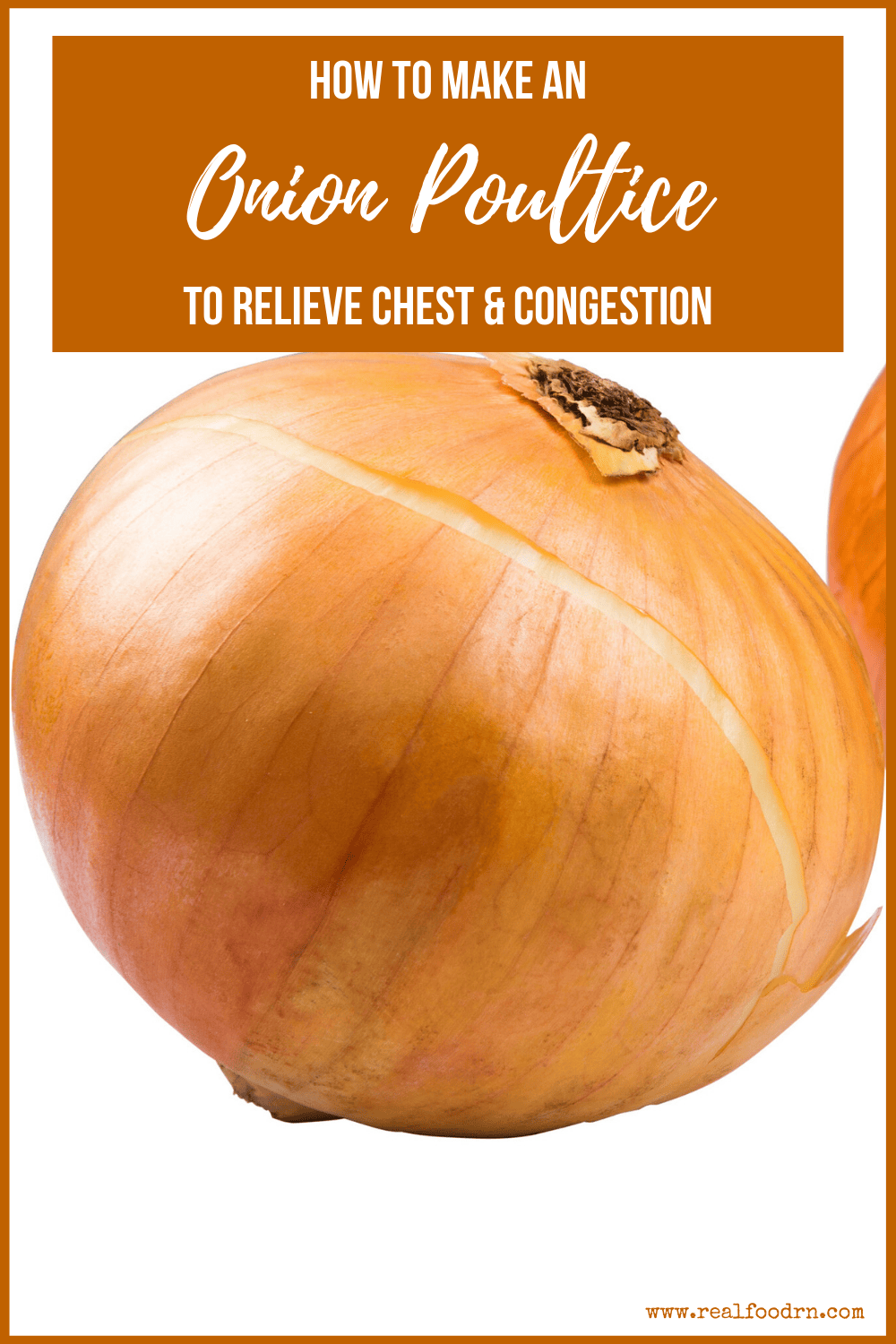 How to Make an Onion Poultice to Relieve Chest & Cough Congestion