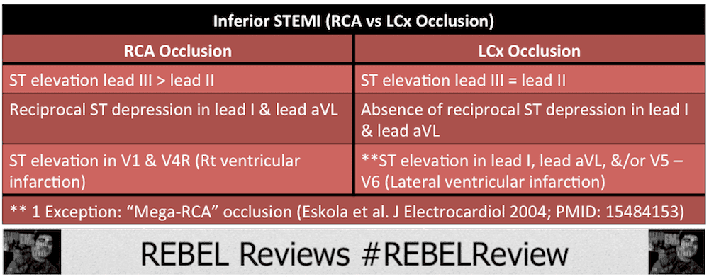 R.E.B.E.L. ECG of the Week 2 REBEL EM Emergency Medicine Blog