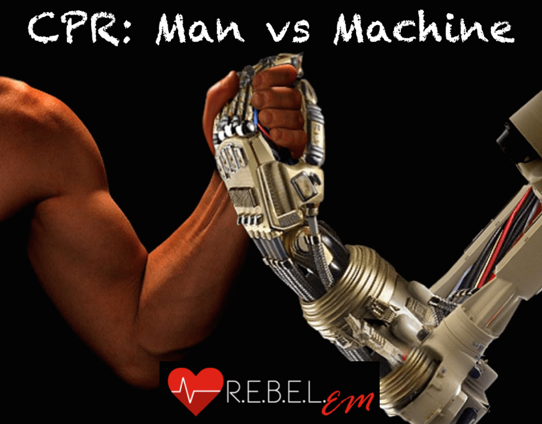 CPR in Out of Hospital Cardiac Arrest Man vs Machine R.E.B.E.L. EM