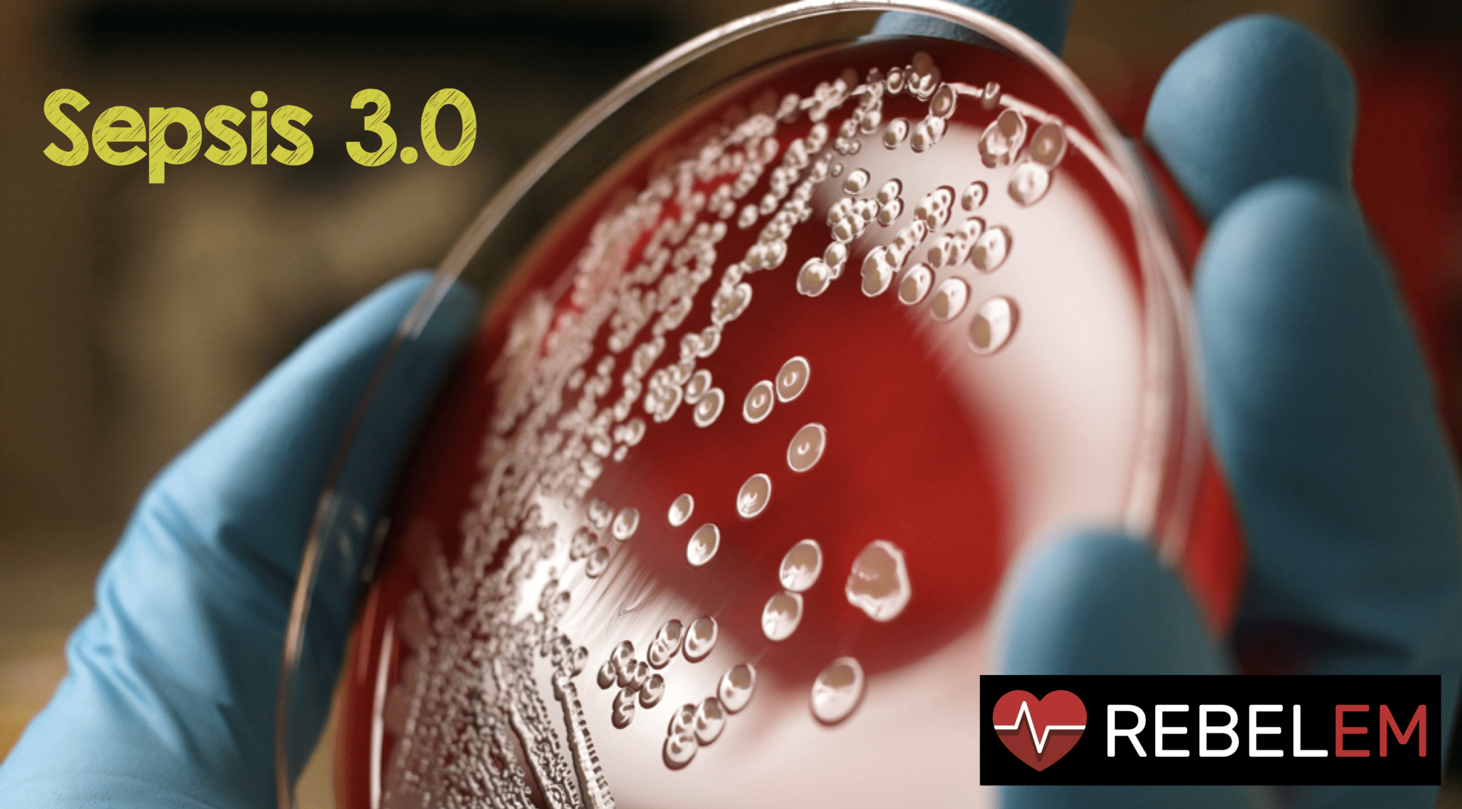 Sepsis 3.0 REBEL EM Emergency Medicine Blog