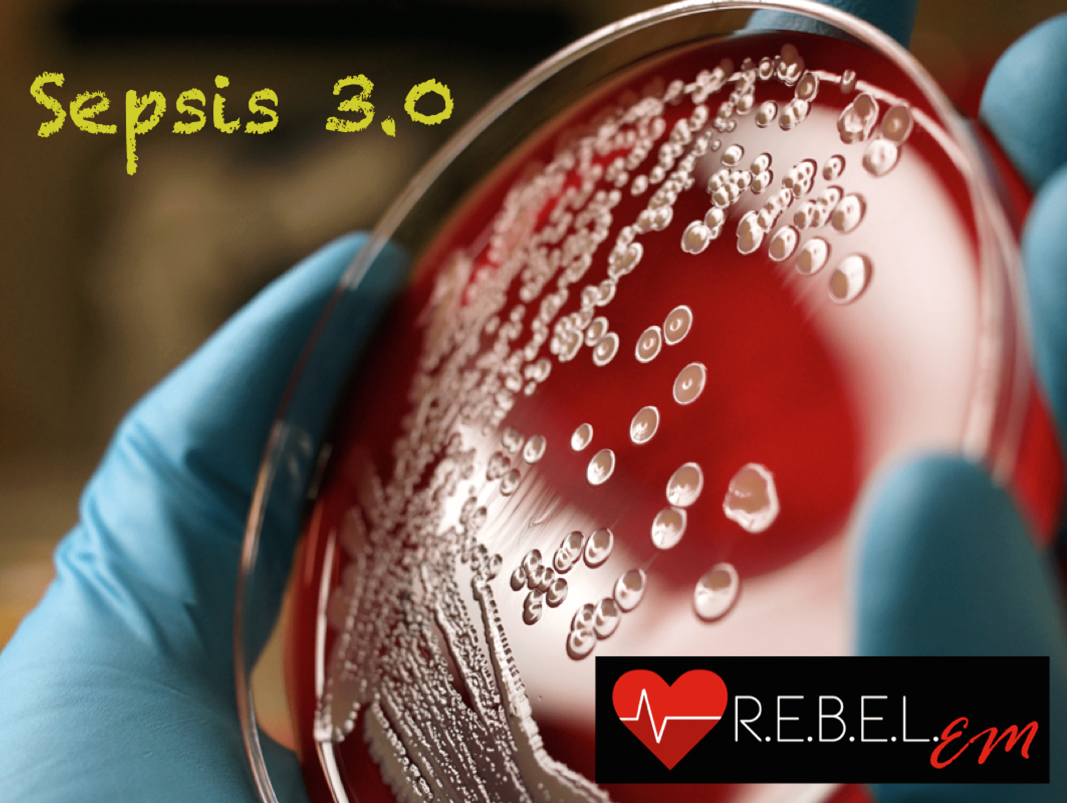 Sepsis 3.0 R.E.B.E.L. EM Emergency Medicine Blog