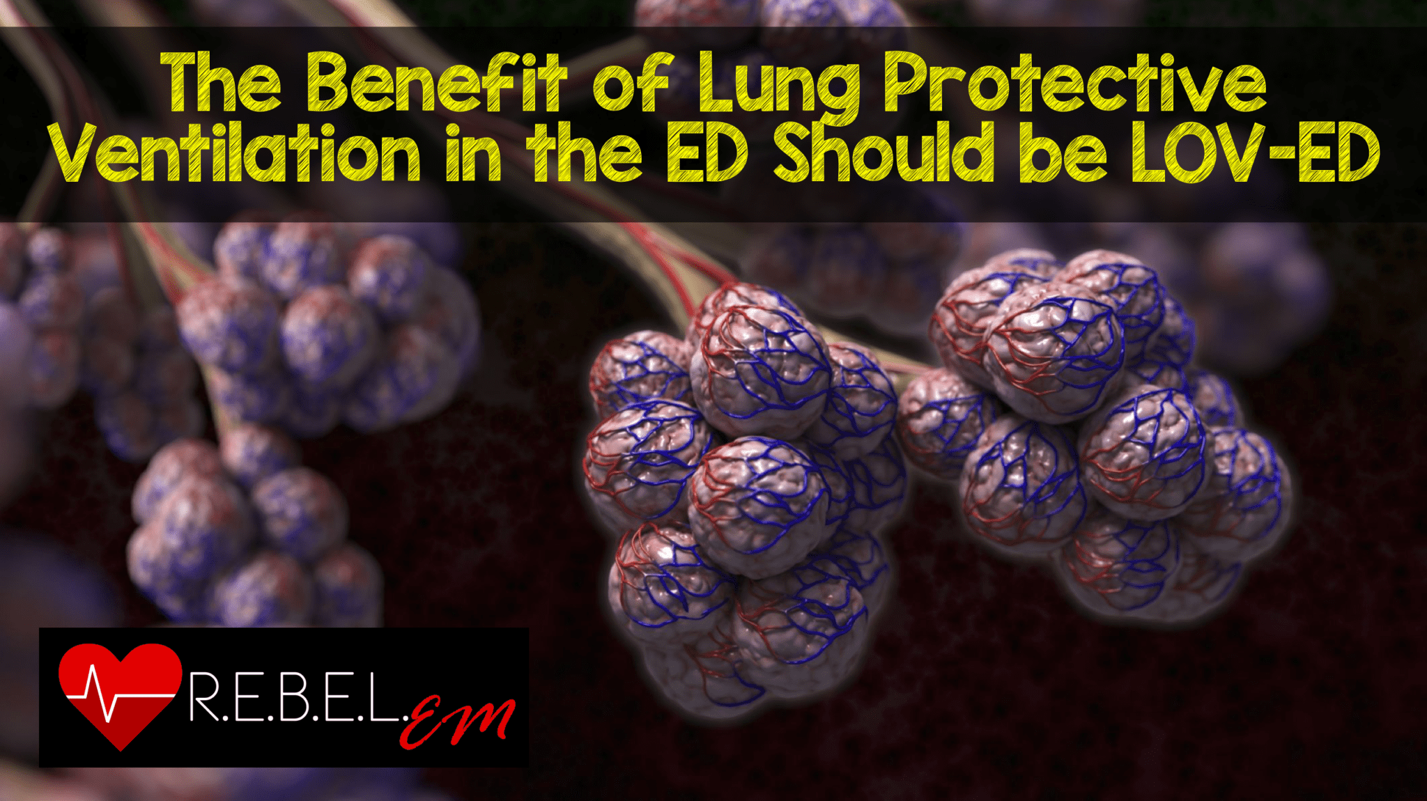 The Benefit of Lung Protective Ventilation in the ED Should be LOVED