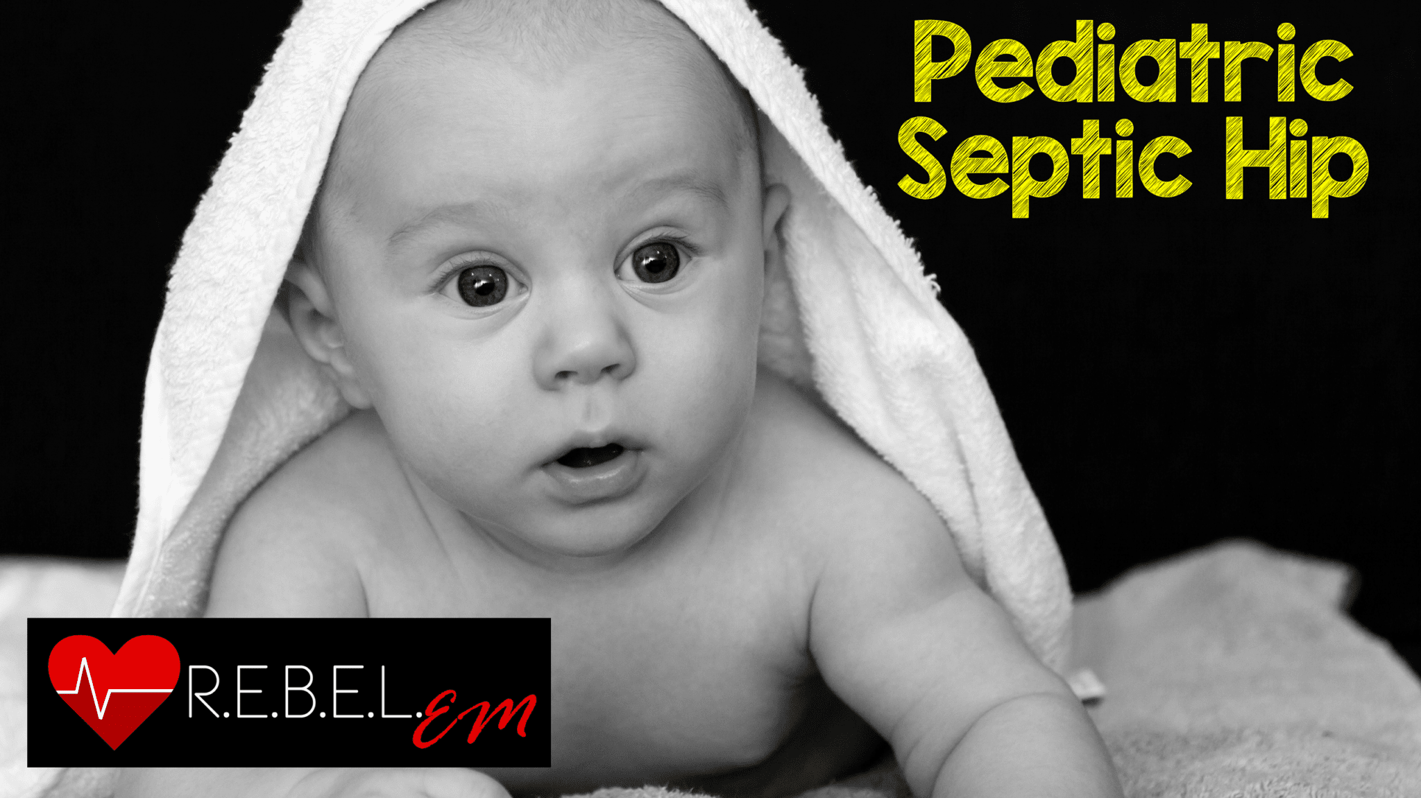 Pediatric Septic Hip R.E.B.E.L. EM Emergency Medicine Blog