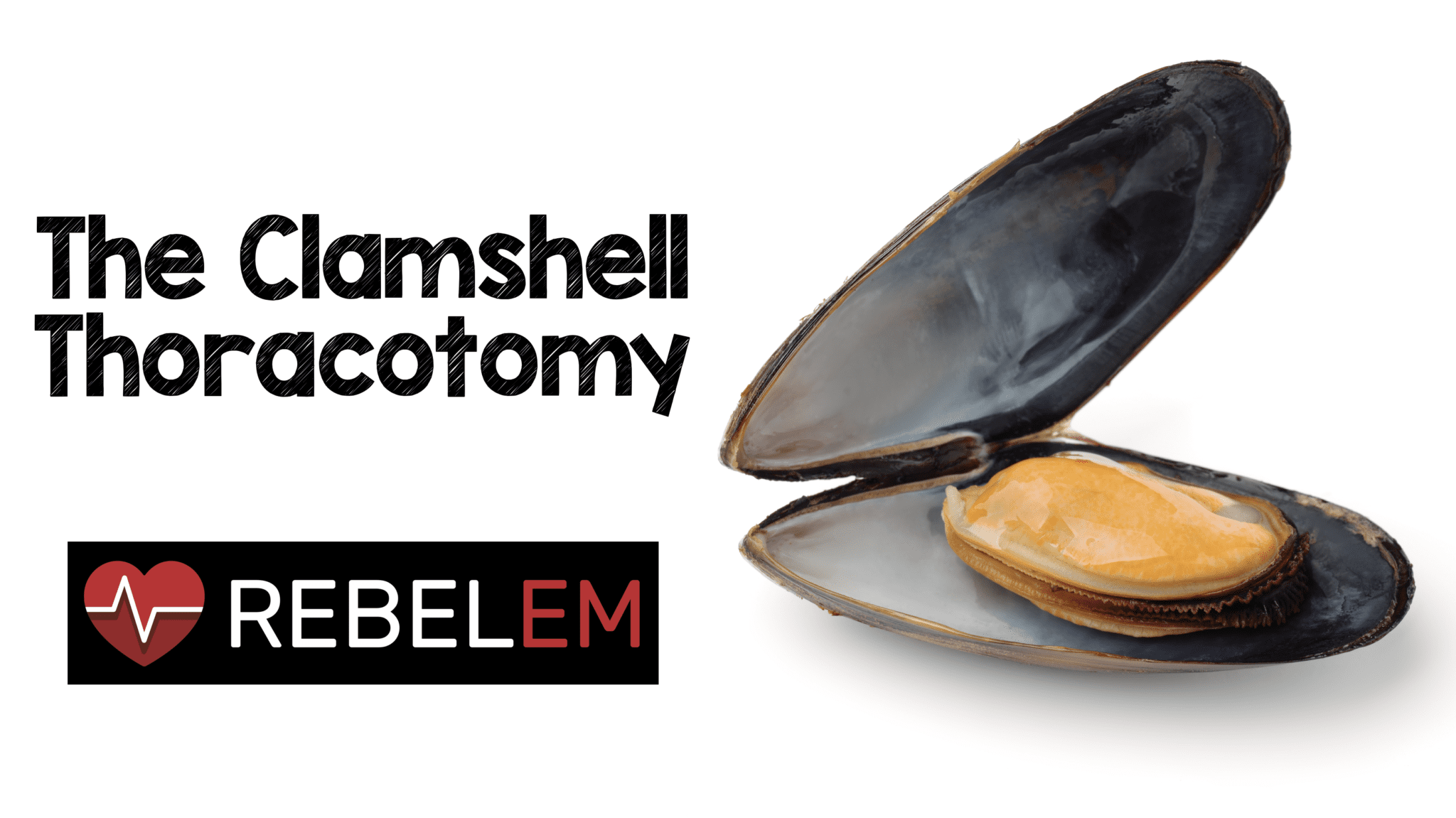If You’re Going to do the Thoracotomy…do a Clamshell REBEL EM