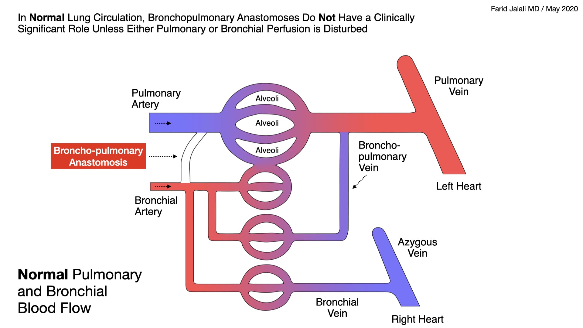 Normal Pulmonary and Bronchial Flow REBEL EM Emergency Medicine Blog