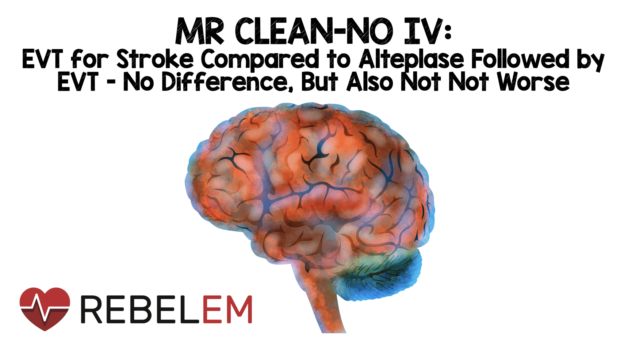 MR CLEANNO IV Endovascular Treatment for Stroke Compared to Alteplase