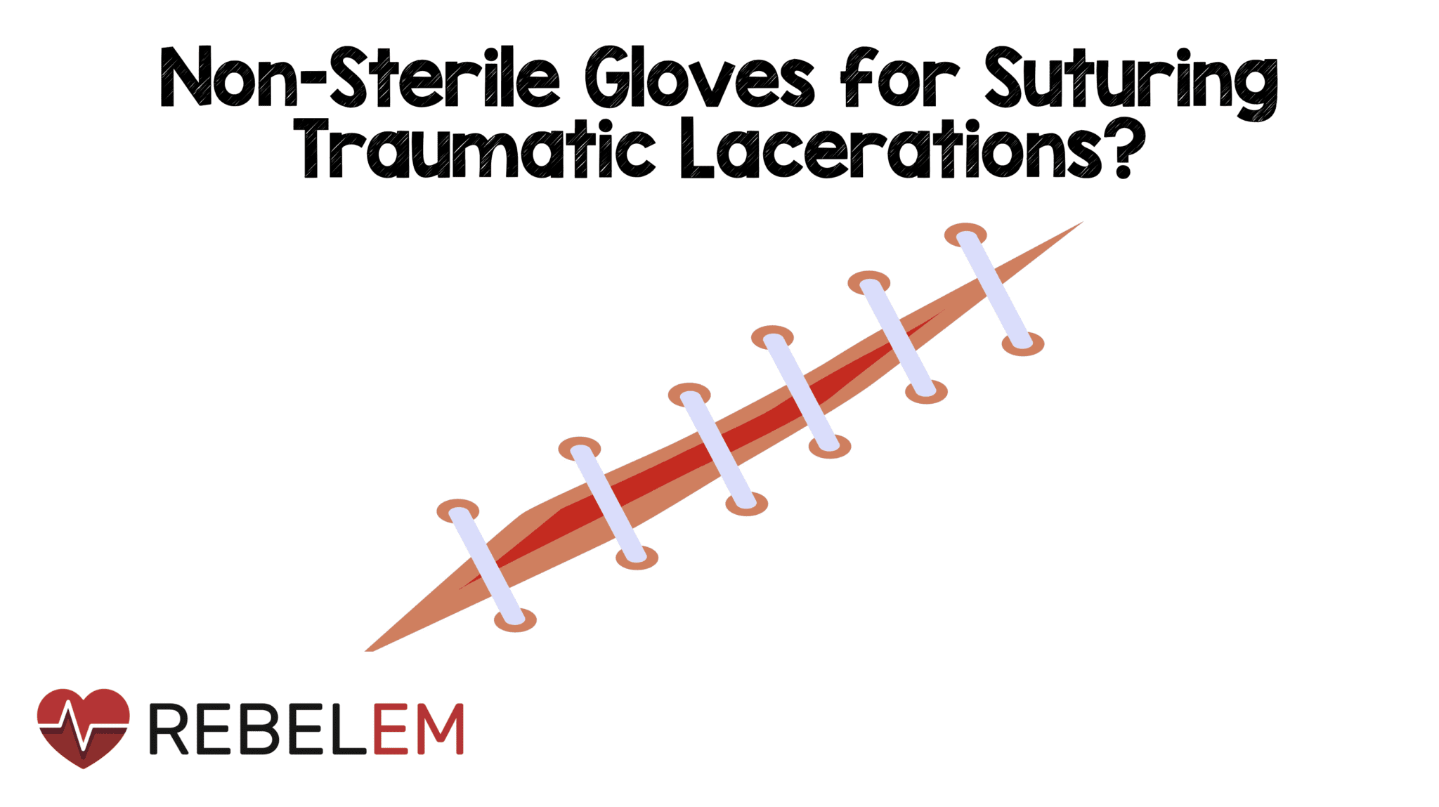 NonSterile Gloves for Suturing Traumatic Lacerations? MEDTAC