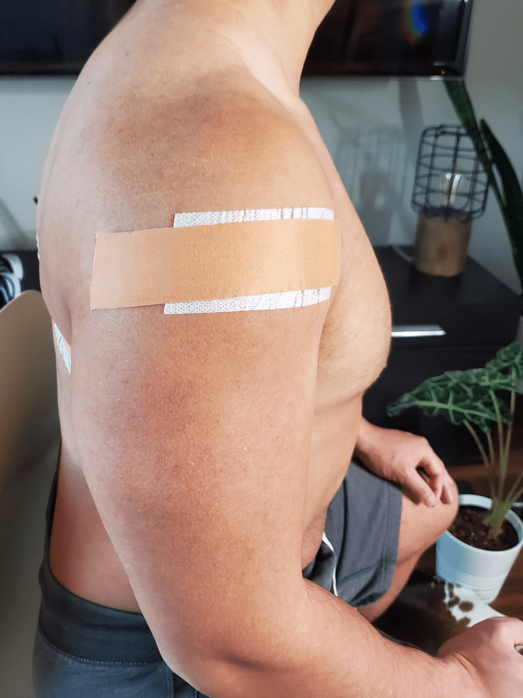 Taping Shoulder for Pain Relief Physiotherapy Toronto