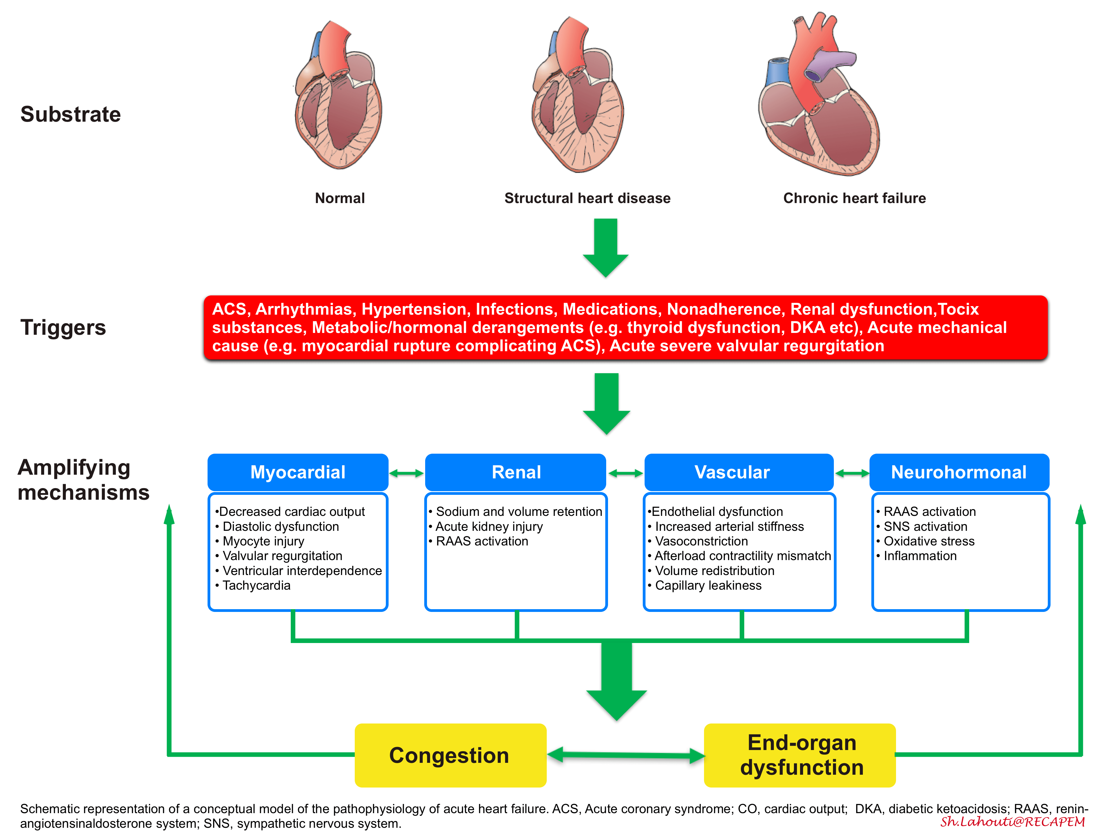 Sympathetic Crashing Acute Pulmonary Edema (SCAPE) Insight into