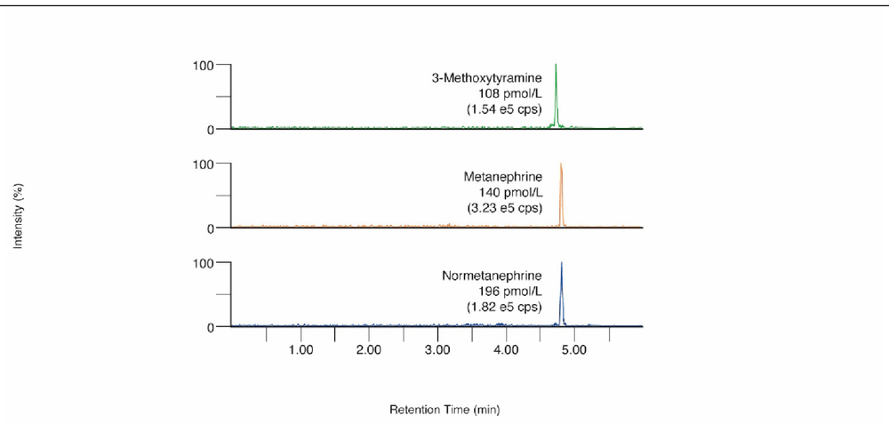 Free Metanephrines in Plasma ⎜ RECIPE