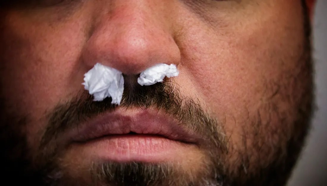 Does Alcohol Cause Nose Bleeds? Recovery Ranger