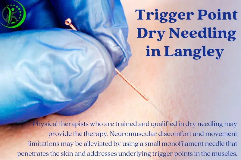 Do You Want To Know The Benefits Of Dry Needling Physiotherapy?