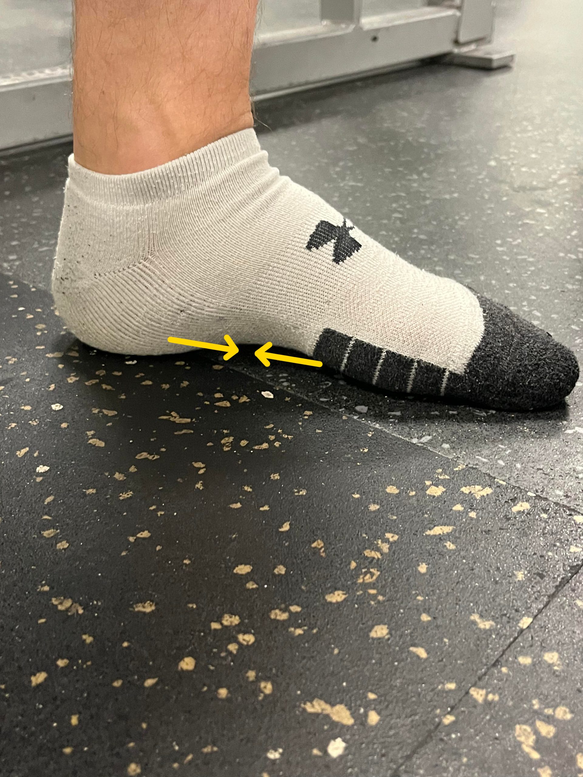 Plantar Fasciitis After a Sprained Ankle Rehab 49