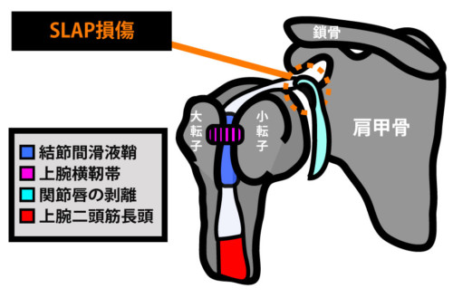 ãSLAPæå·ãã®ç»åæ¤ç´¢çµæ