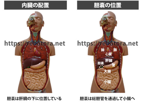 胆嚢の問題の典型的な症状は何ですか?