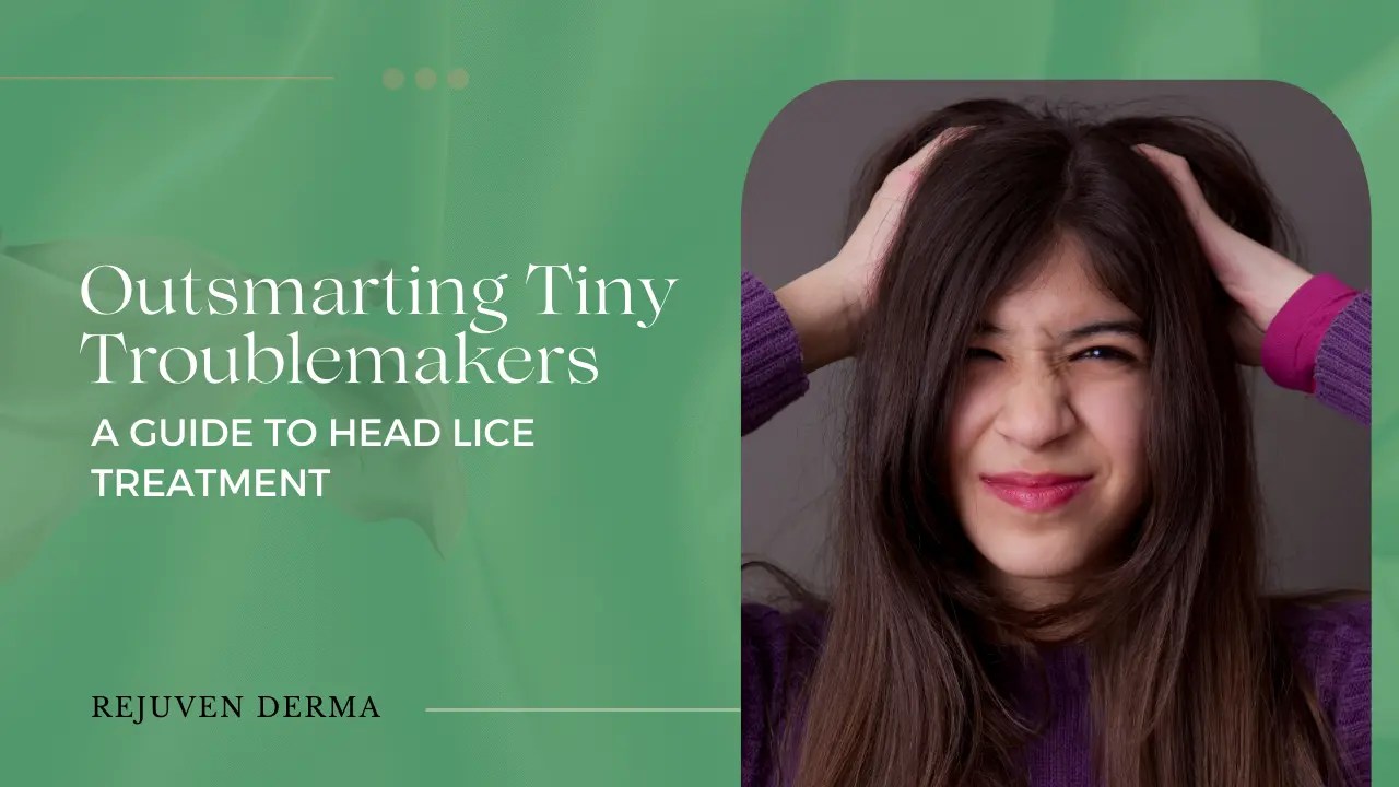 Outsmarting Tiny Troublemakers A Guide to Head Lice Treatment in