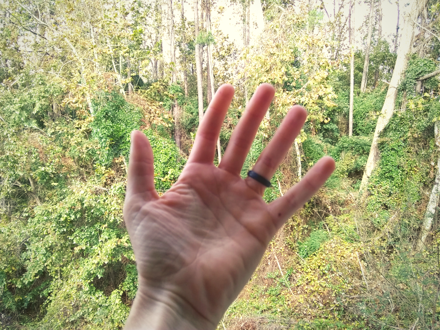 7 Reasons Why Your Hands Swell When Running or Walking RELENTLESS