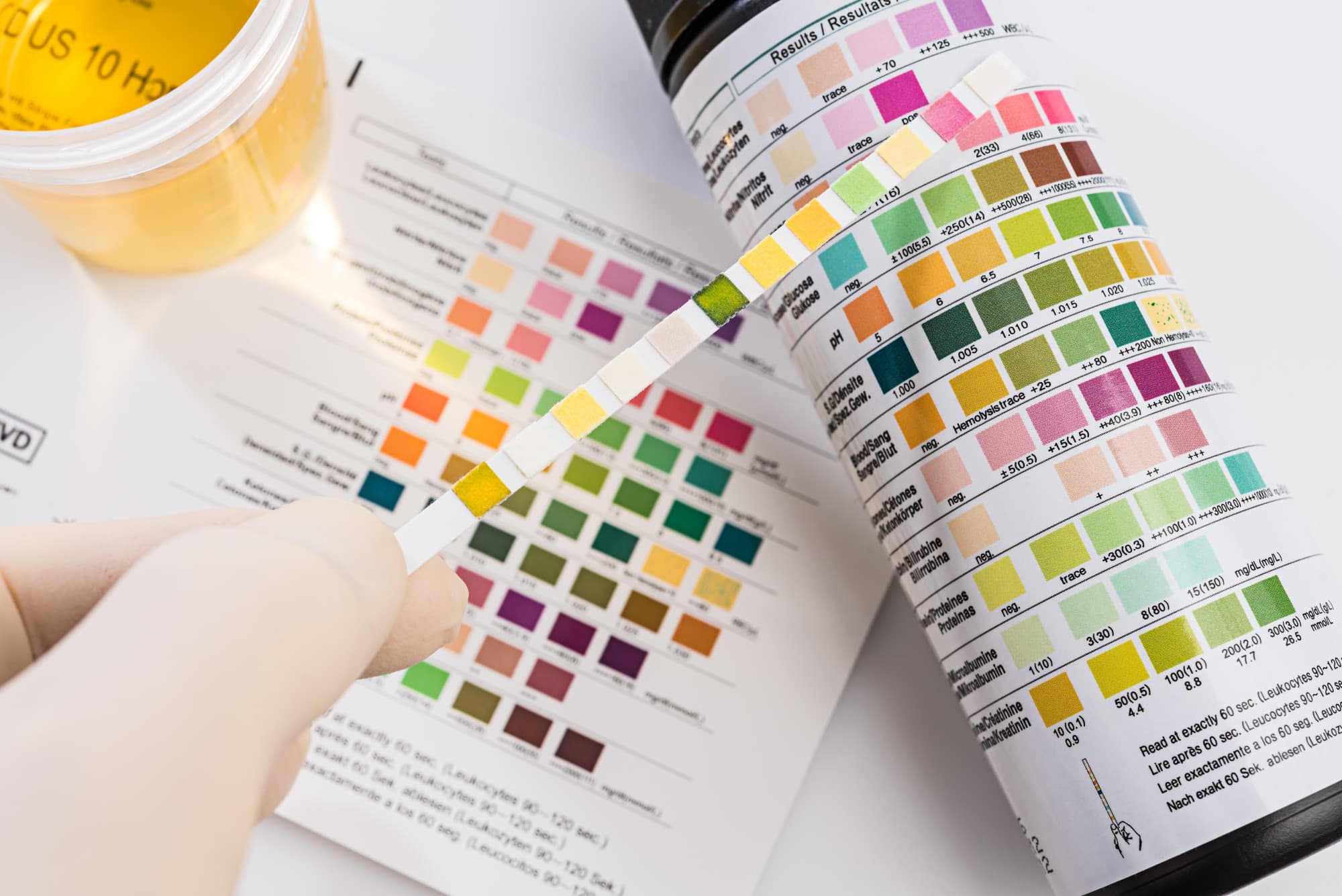 Are There Urine Drug Tests You Can Order Online? Relialab Test