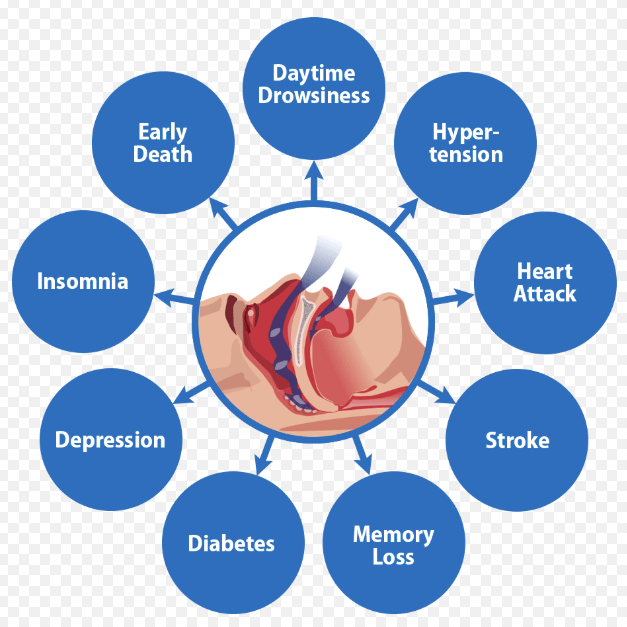 What Is Sleep Apnea Orange County CA Remarkable Smiles
