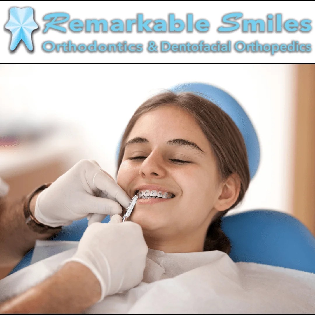 How Tooth Extraction Affects Dental Braces Remarkable Smiles