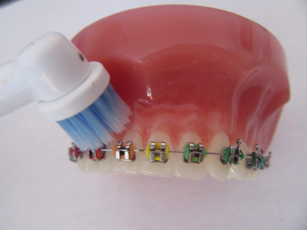 The Secrets to Good Toothbrushing with Braces