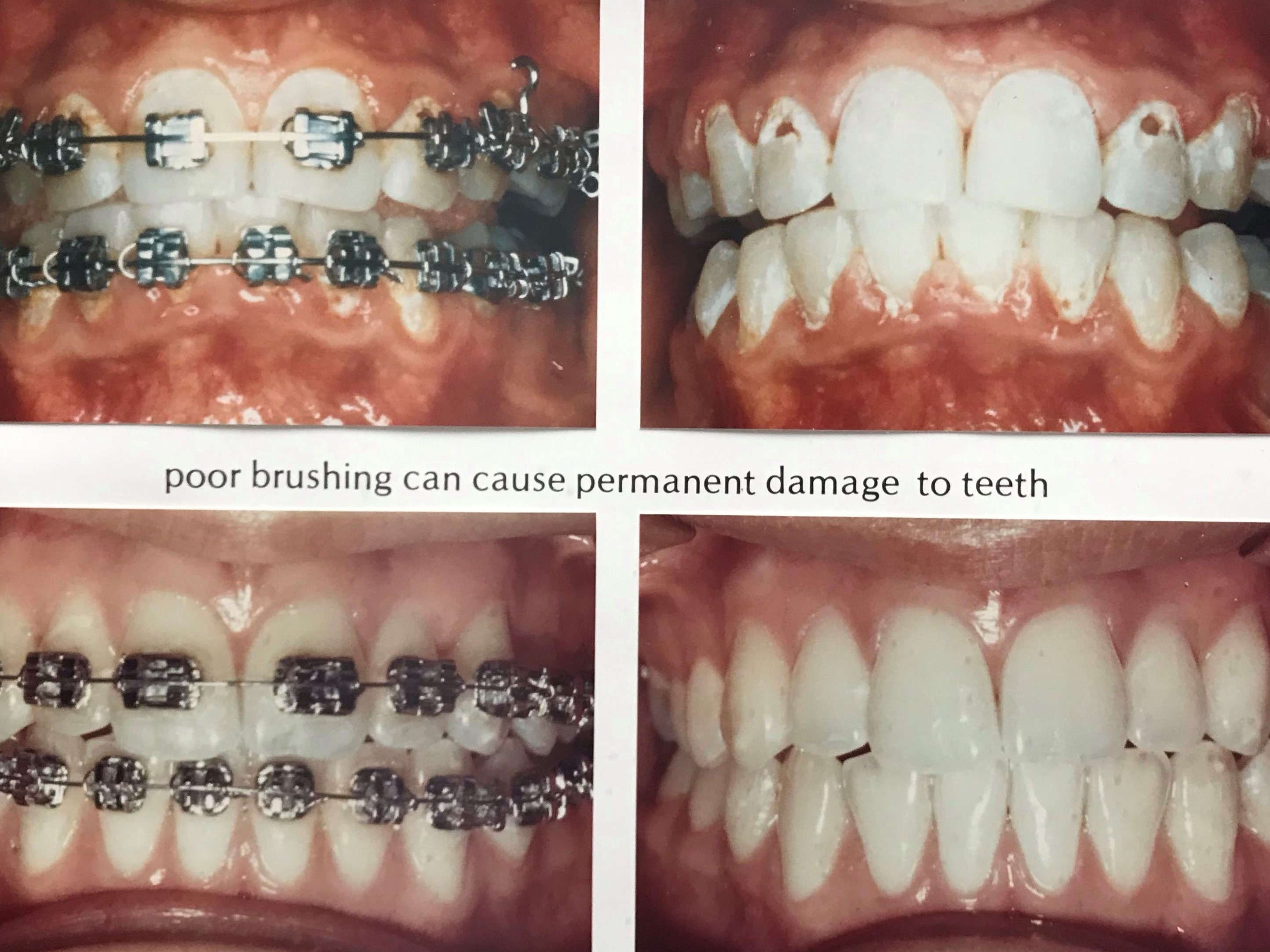 A Healthy Smile is a Beautiful Smile! Remington Smiles Kendra J