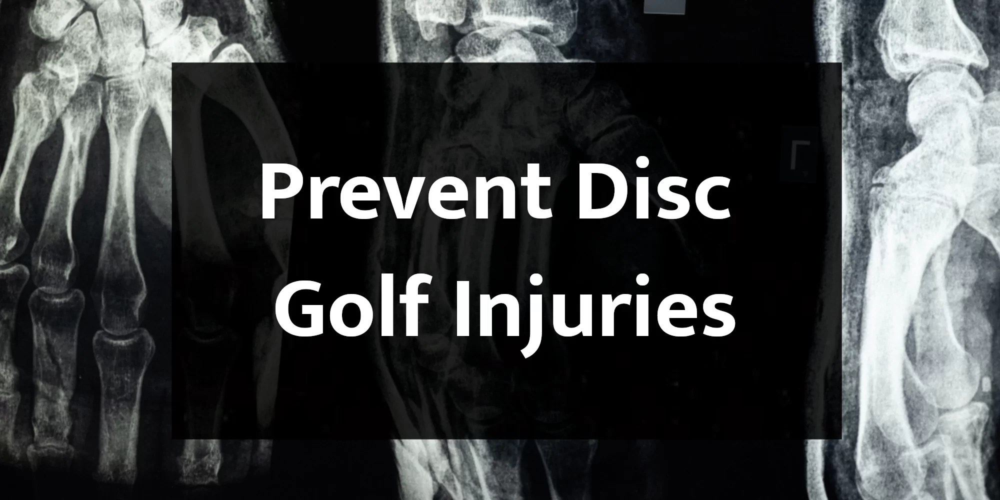 Common Disc Golf Injuries and How to Prevent Them
