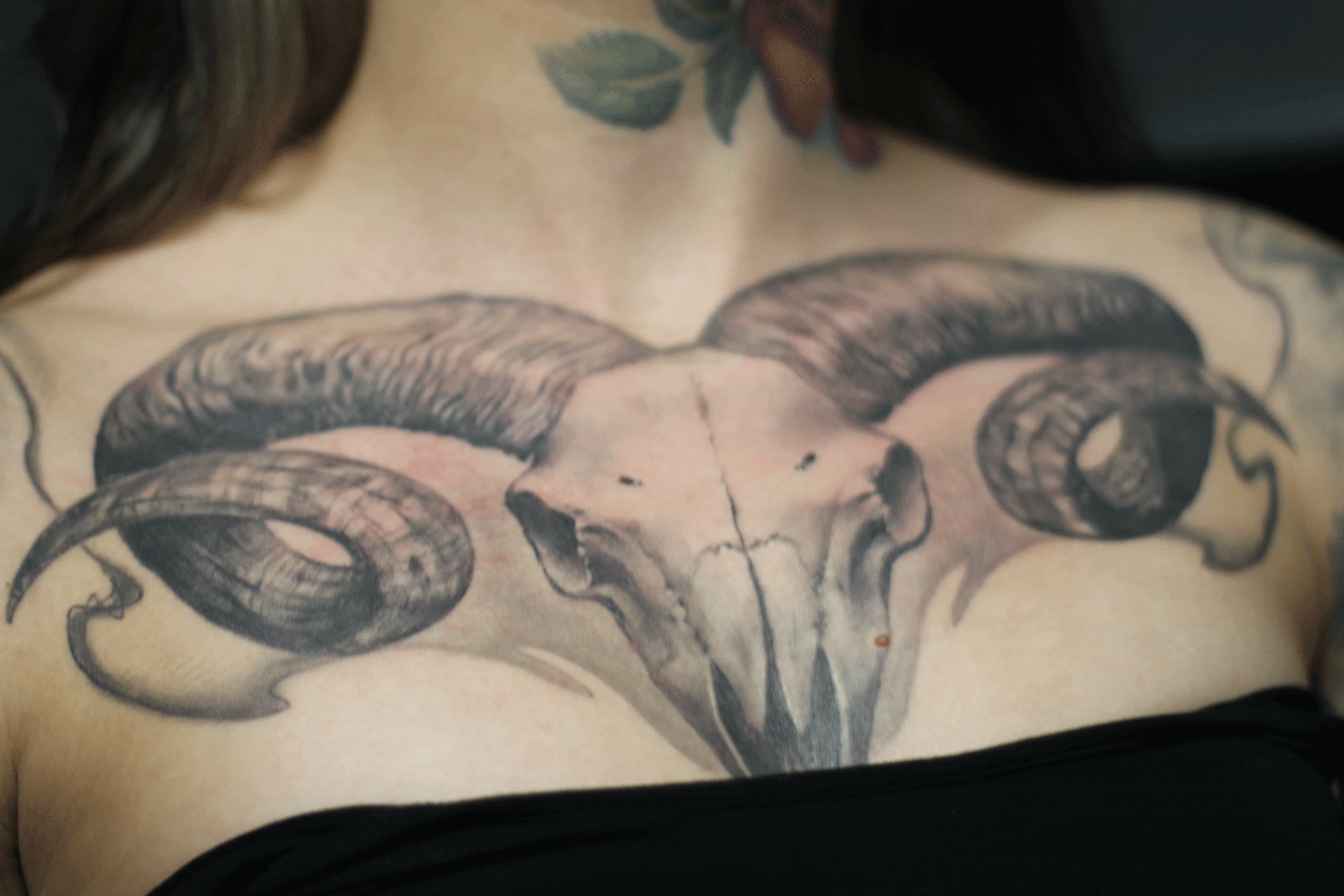 Laser Tattoo Removal And Pregnancy / Picosure Laser Tattoo Removal Is