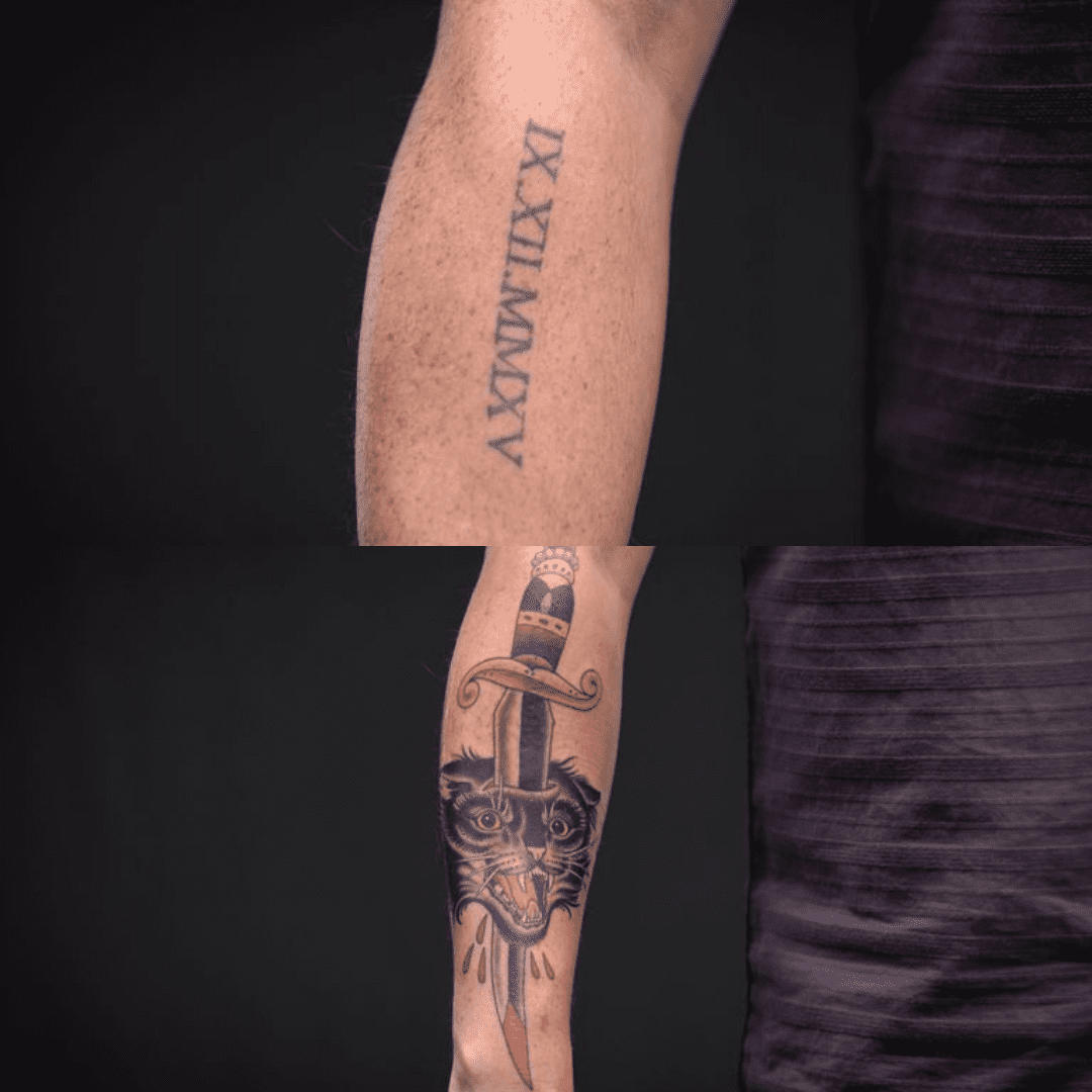 Tattoo Redo Netflix's Tattoo Cover Up Show Removery