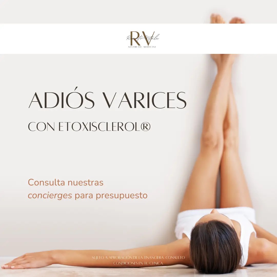 Tratamiento de Varices Con Etoxisclerol® Renato Vitale