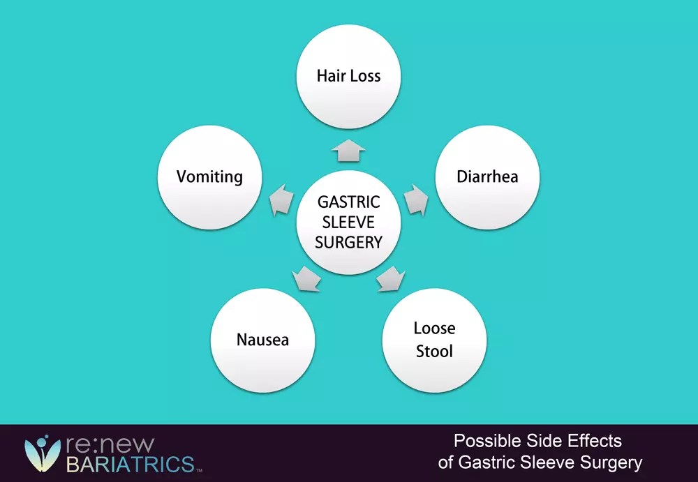 Side Effects of Gastric Sleeve Surgery Renew Bariatrics