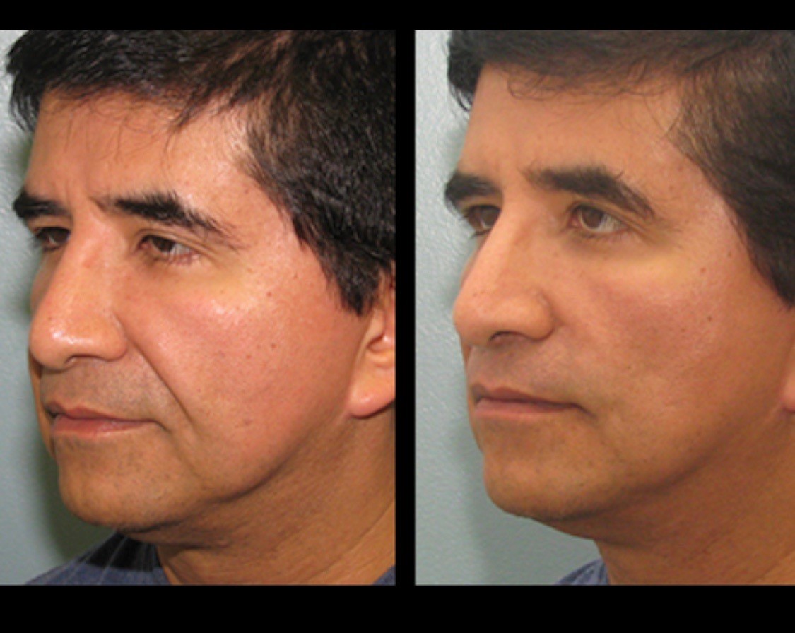 PDO Event Page Renew