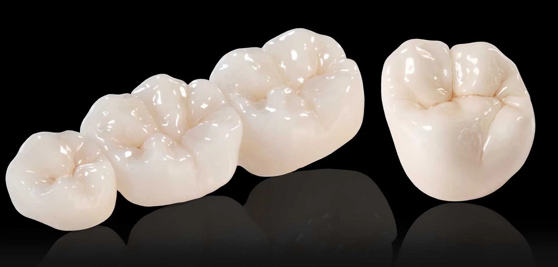 Crowns Falls Church Arlington VA General Dentistry