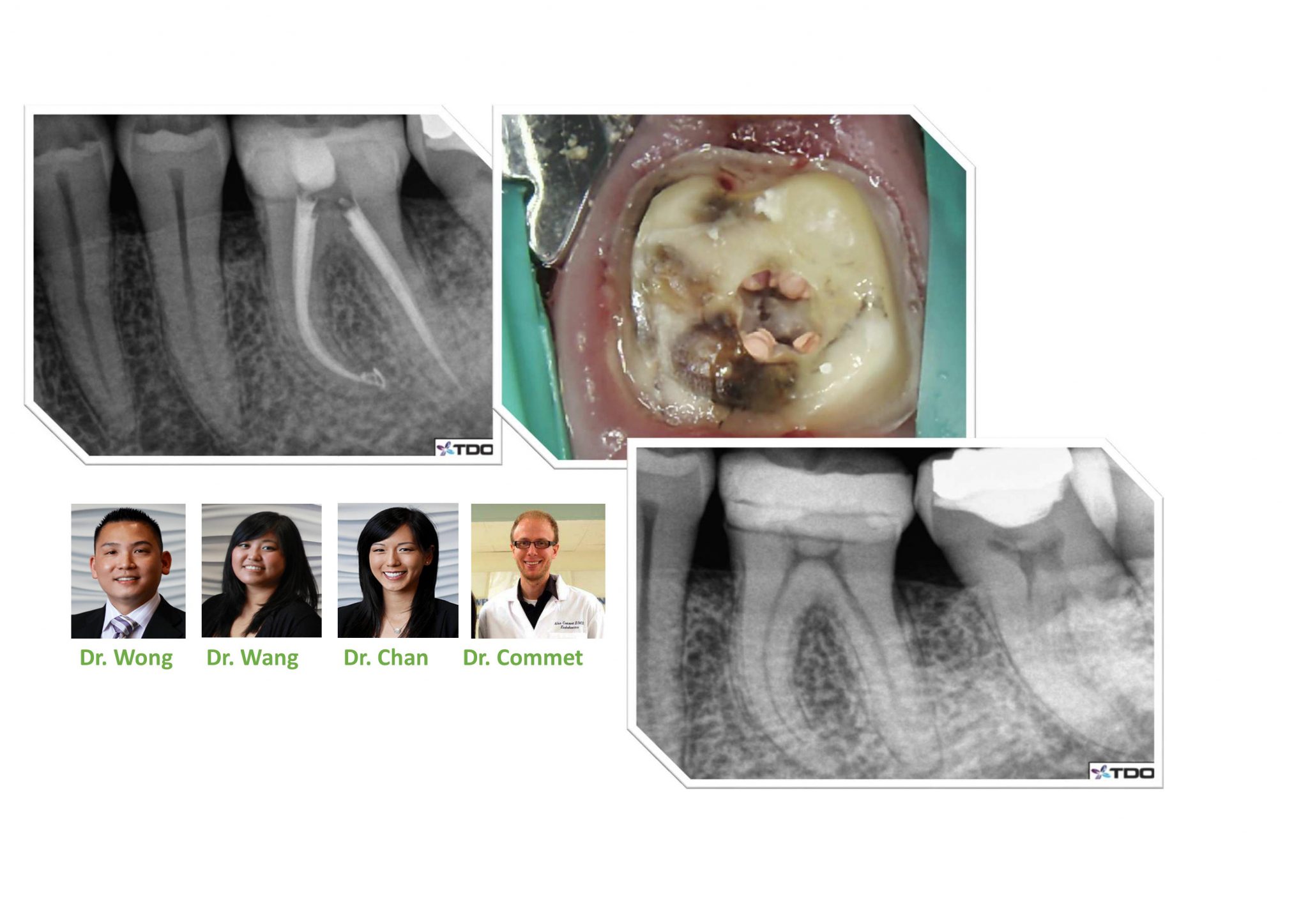 "Modern Endodontic Instruments" Renovo Endodontic Studio