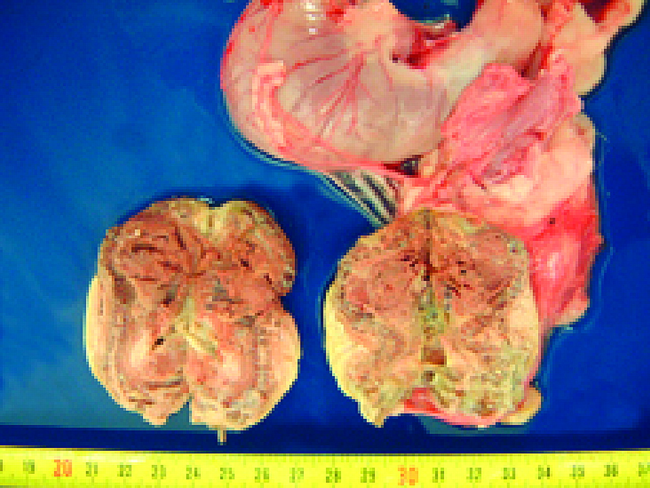 Ectopic pregnancy in animals and humans in Reproduction