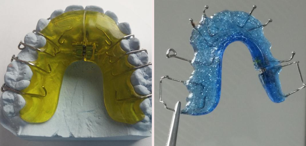 How to Fix a Broken Retainer Wire | Detailed Guide (2025)