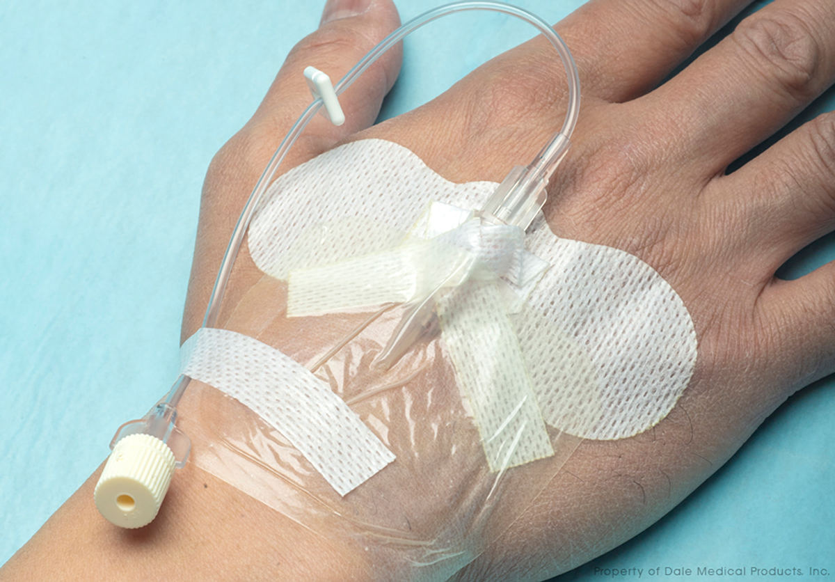Clinical Guidelines Support the Use of Dale® HoldnPlace® Catheter