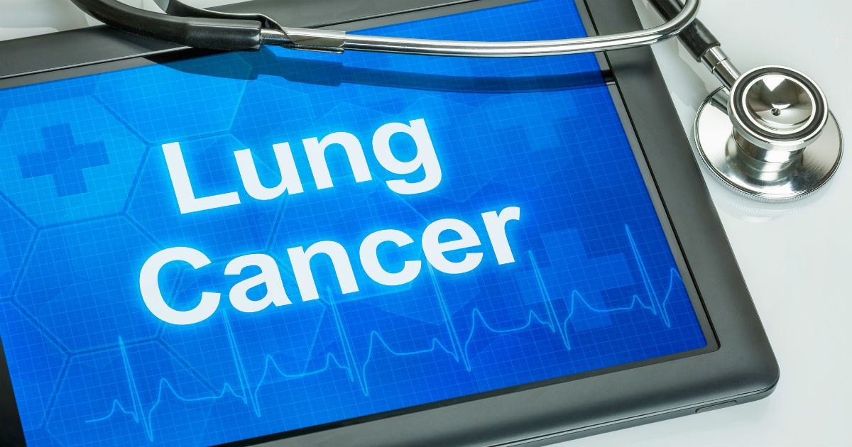 lungcancer · GitHub Topics · GitHub