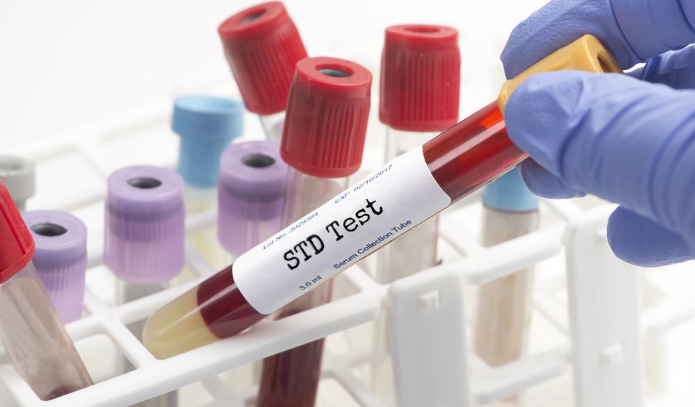 Online STD Test Order STD Test Online Request A Test