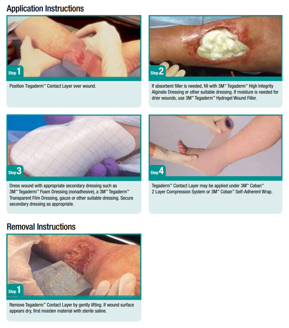 3M 5644 Tegapore Wound Dressing 8x10 5x4/CS CIA Medical