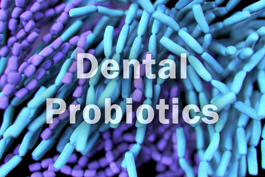 Dental Probiotics Q&A What do they really do? Anything? News from