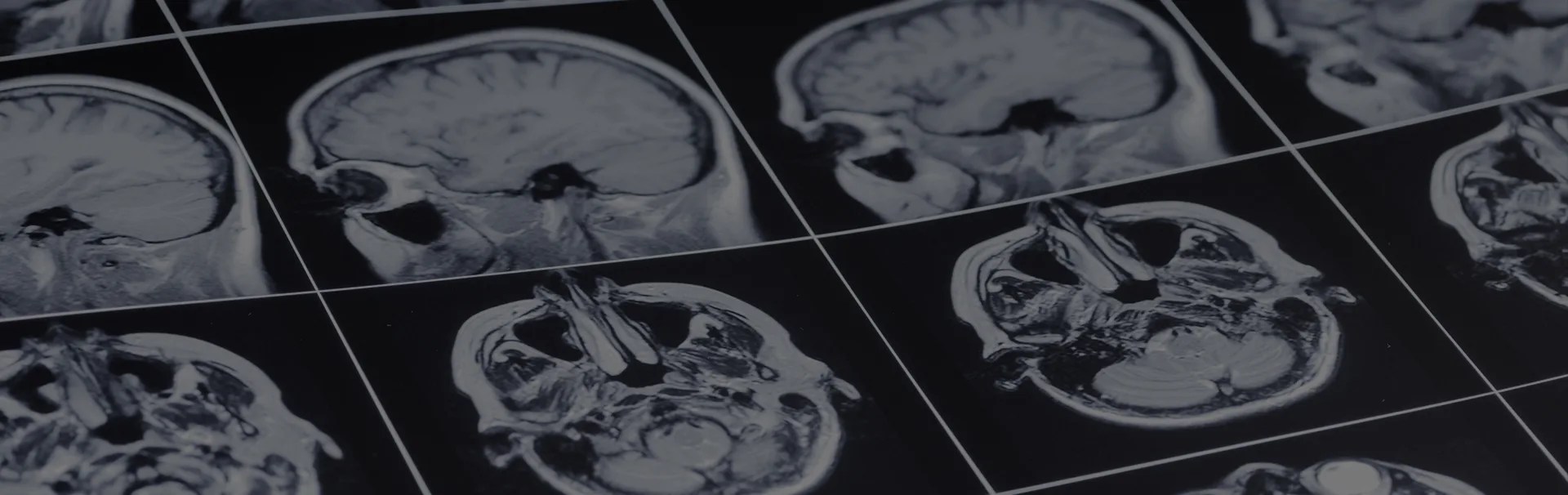 Anesthesia Errors Lawyers Cherry Hill NJ Camden Anesthesia Accidents