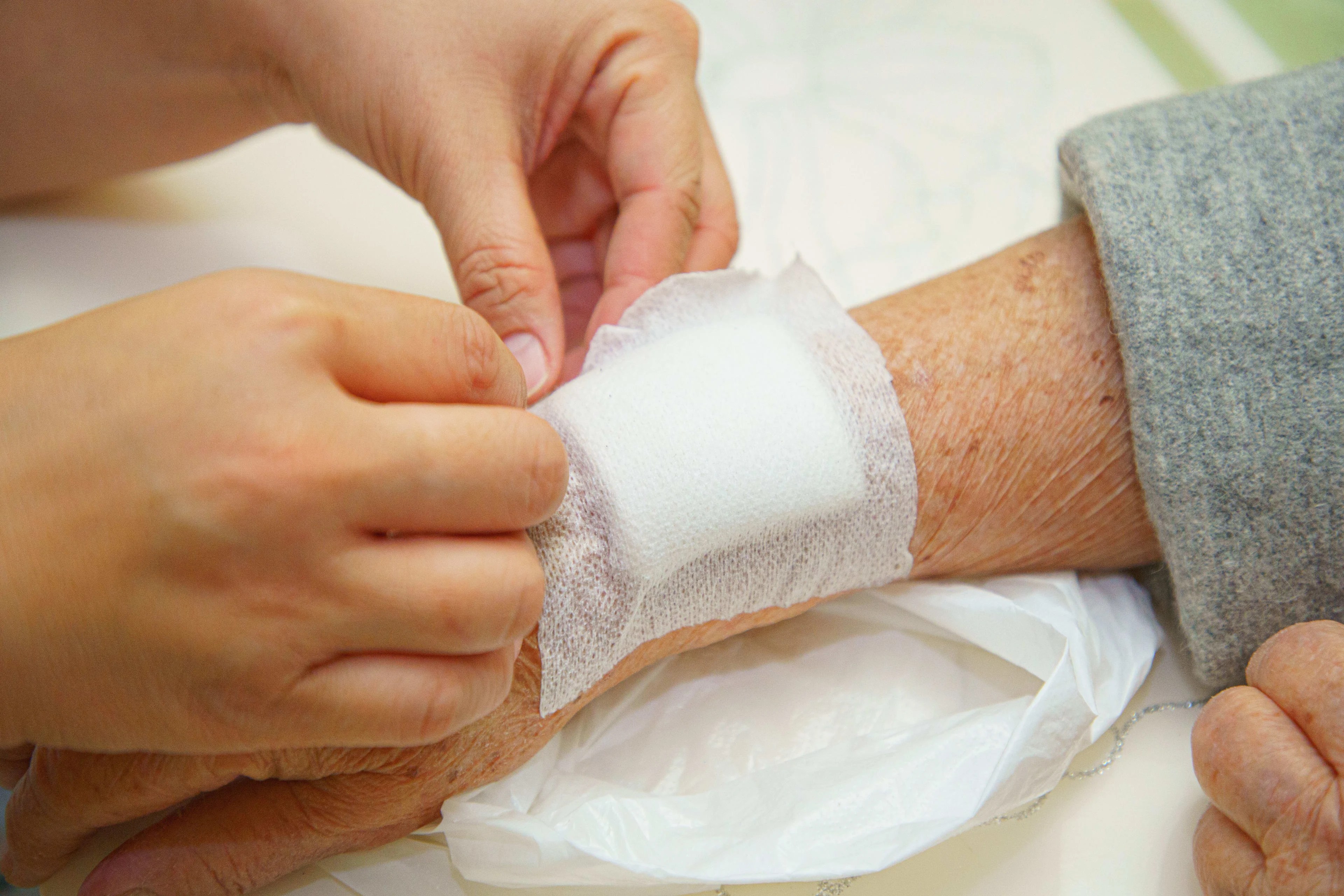 Wound Care Treatment Treatments UW Health(04)