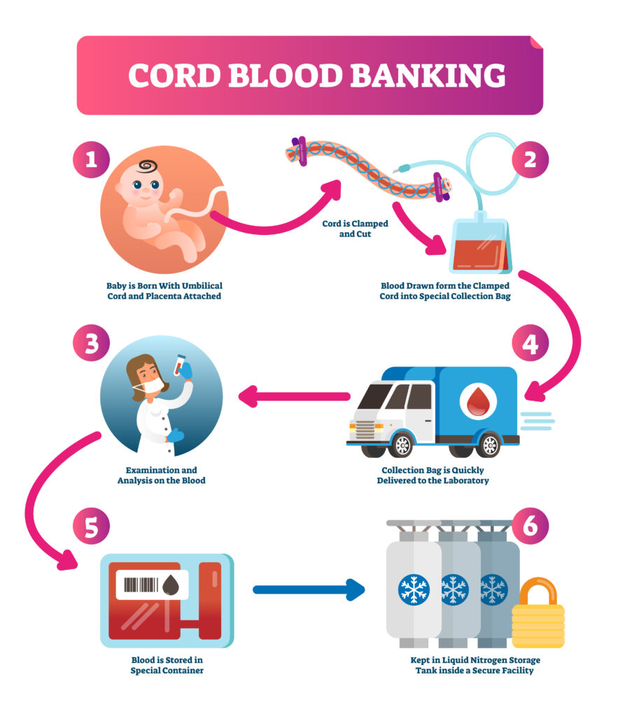Giving life, twice Knowledge and understanding of donating cord blood