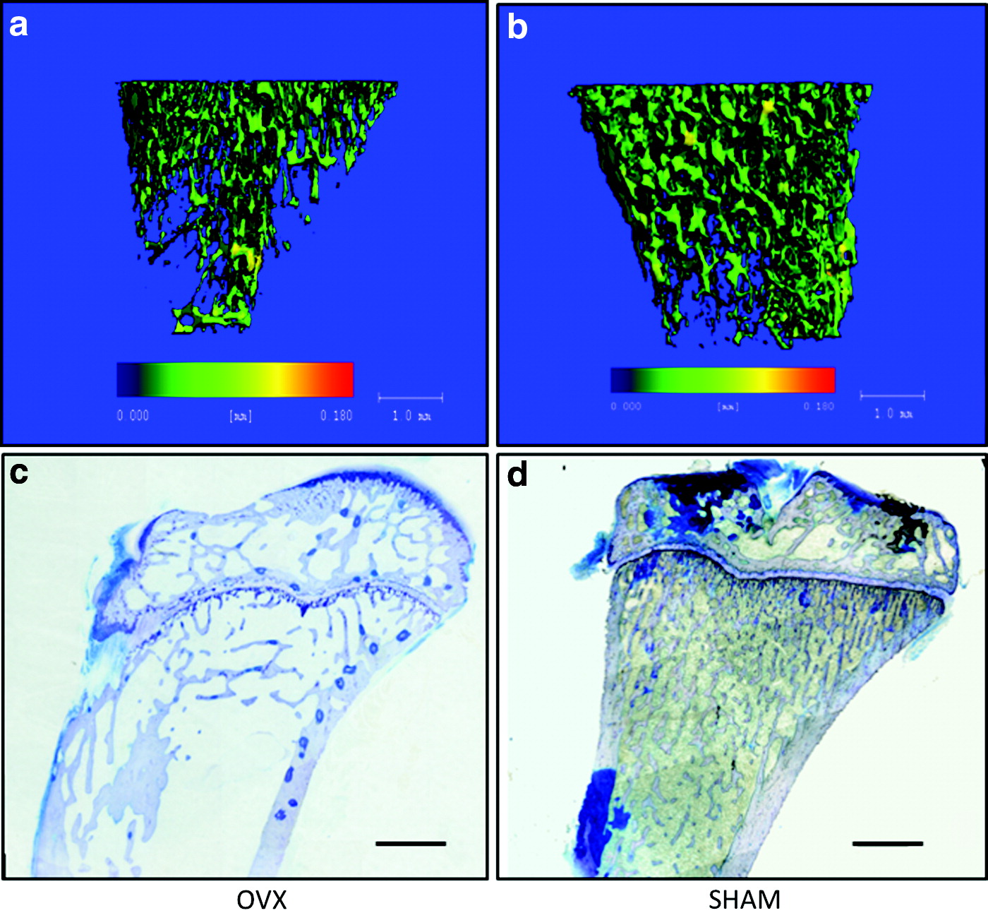 Estrogen deficiencyassociated bone loss in the maxilla A