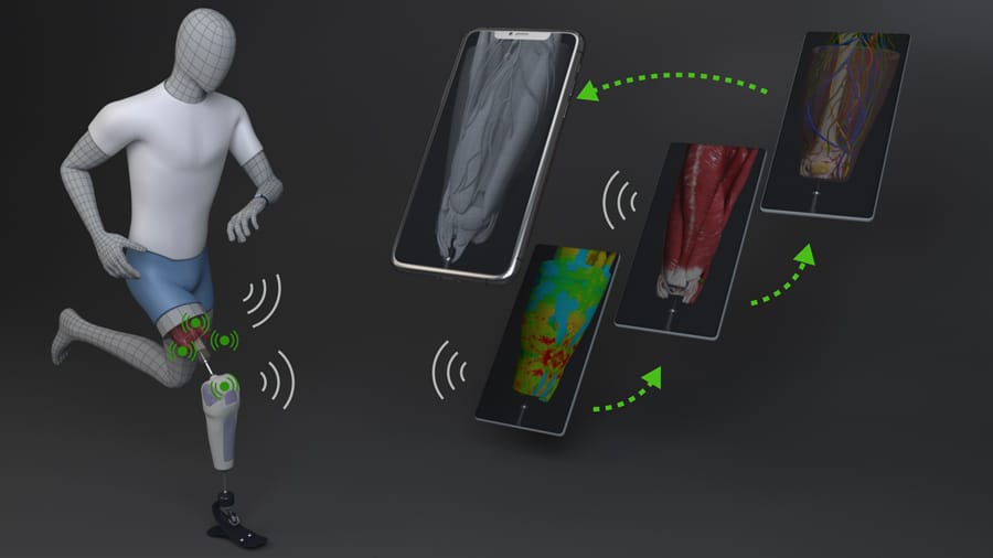 The future of bionic limbs