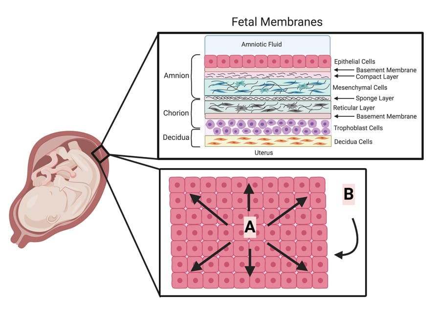 Preterm birth and dangerassociated molecular patterns Research Outreach