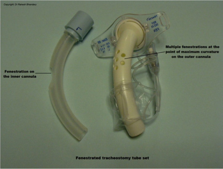 Tracheostomy WFSA Resources