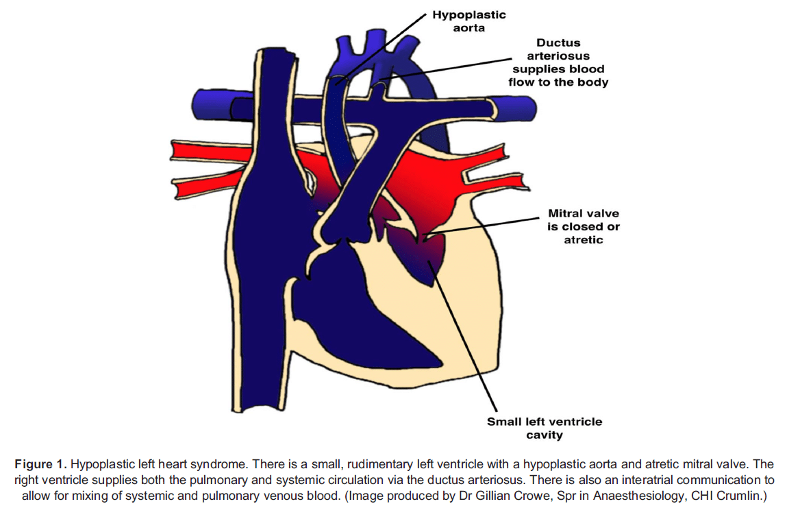 The Pulmonary Artery Catheter WFSA Resources