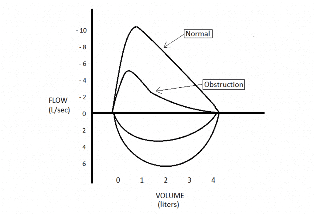 Top 5 Spirometry Tips for COPD Diagnosis and Management Respiratory
